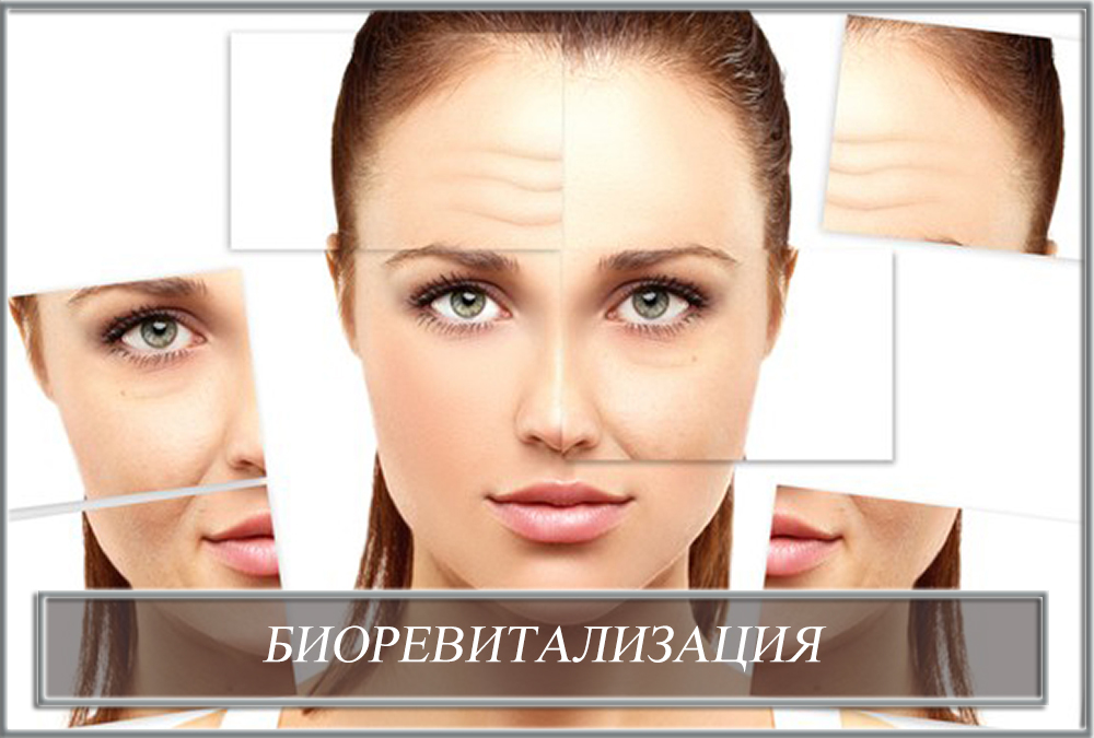 Біоревіталізація