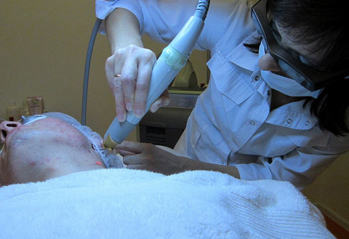 Робота наших лікарів: процедура лазерного омолодження Laser Genesis